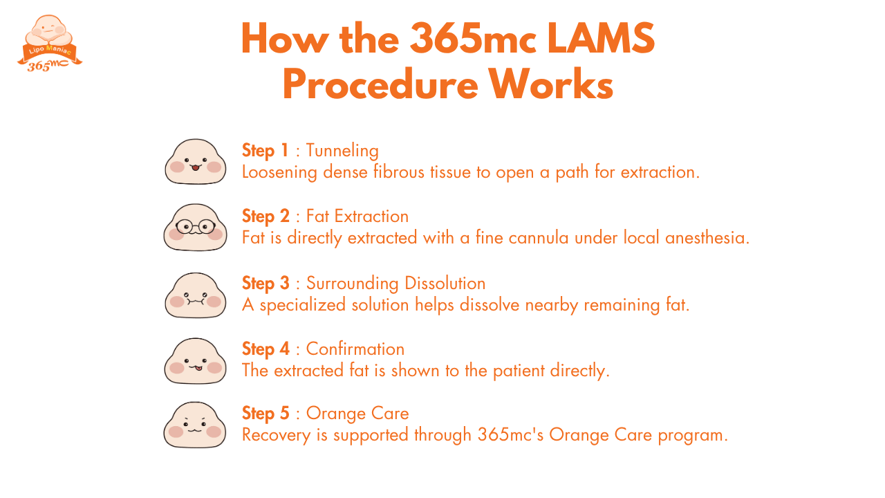 illustration showing the five step process of the 365mc lams procedure