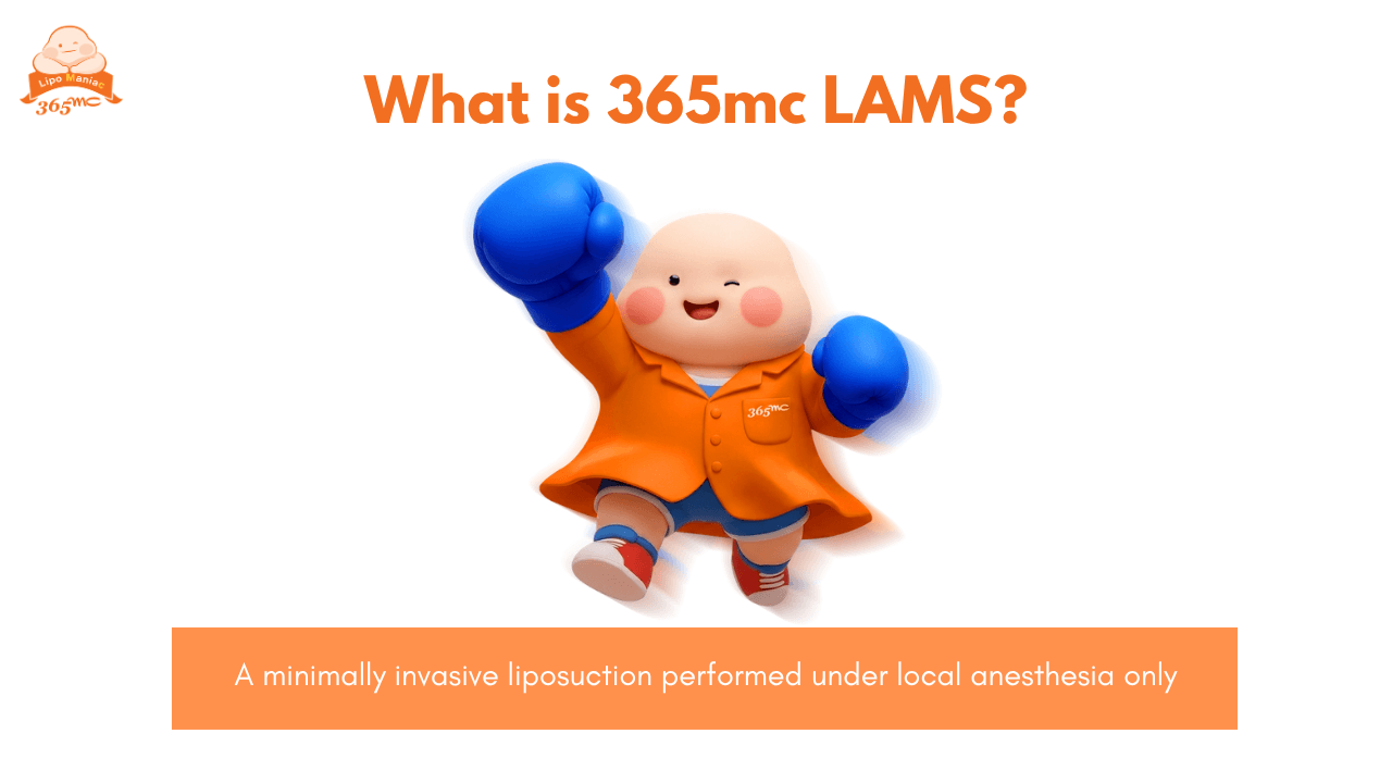 illustration explaining 365mc Local Anesthetic Minimal-Invasive Liposuction