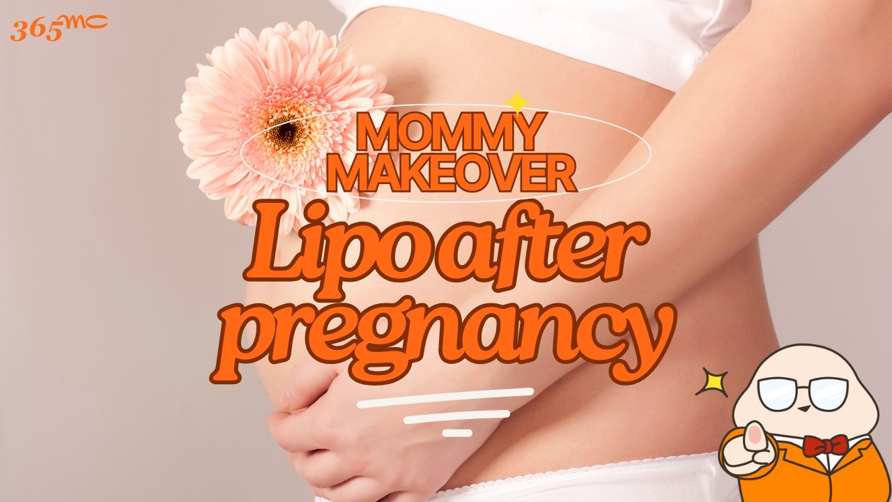 Mommy Makeover: Liposuction After Pregnancy - 365mc medical expertise and patient care
