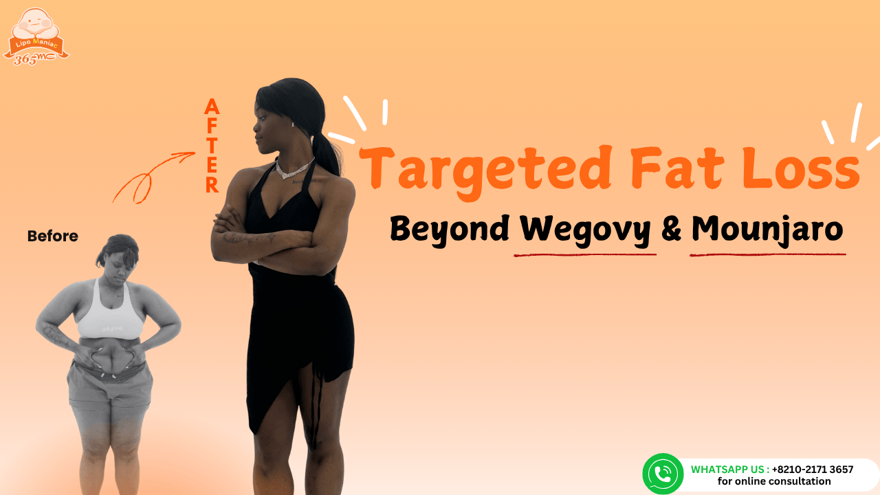 Targeted Fat Loss: Beyond Wegovy & Mounjaro | 365mc