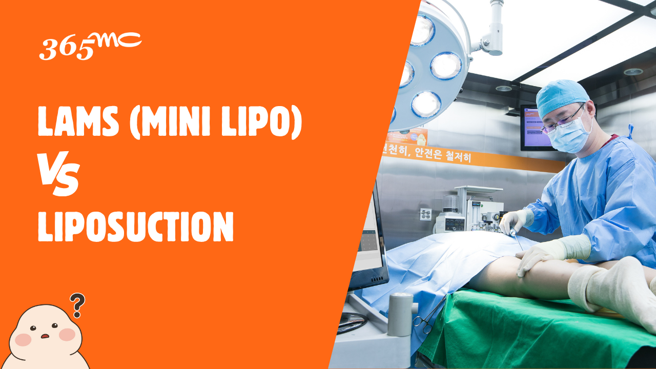 LAMS (mini lipo) vs Liposuction - 365mc medical expertise and patient care
