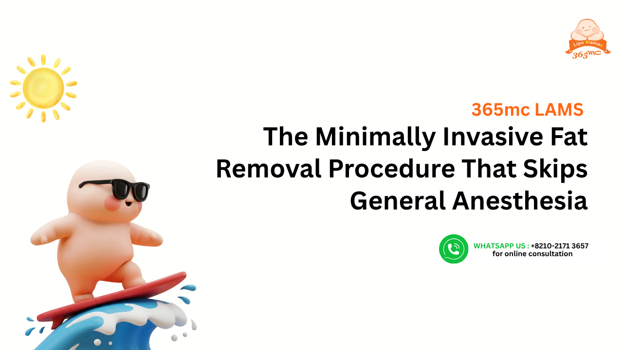 365mc LAMS: The Minimally Invasive Fat Removal Procedure That Skips General Anesthesia