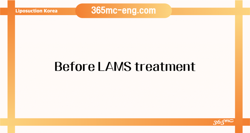 LAMS procedure educational information and patient care details