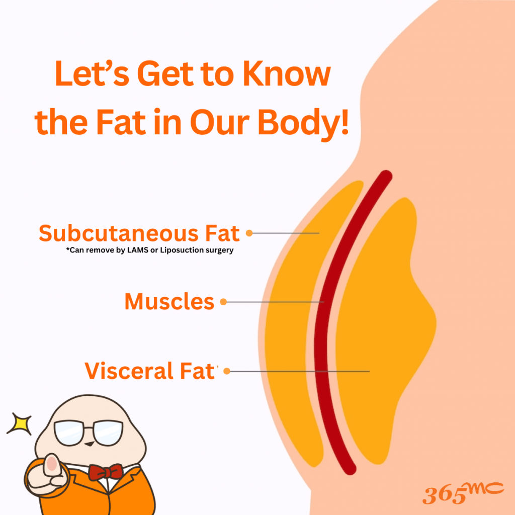 IMAGE 1 FAT 1 1024x1024 LAMS procedure educational information and patient care details