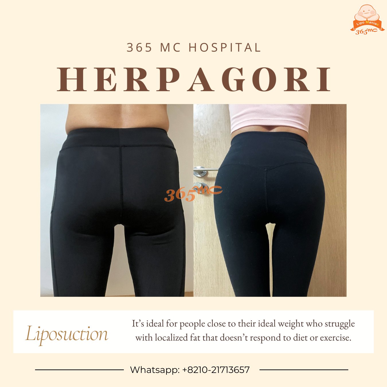 Create Your Feminine Curve with Herpagori! ~ - 365mc medical expertise and patient care