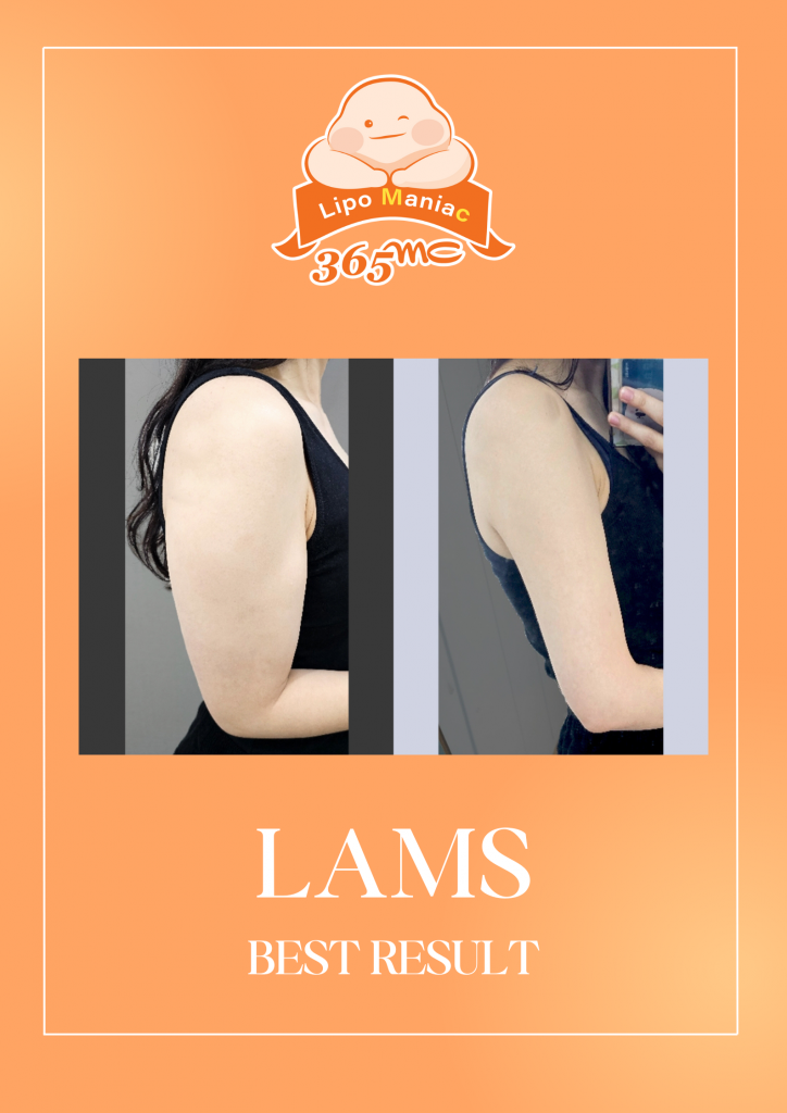 IMAGE 3 LAMS BEST RESULT