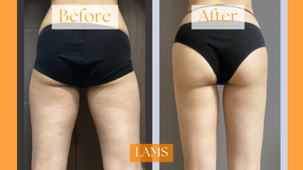 [IMAGE 4 LAMS]