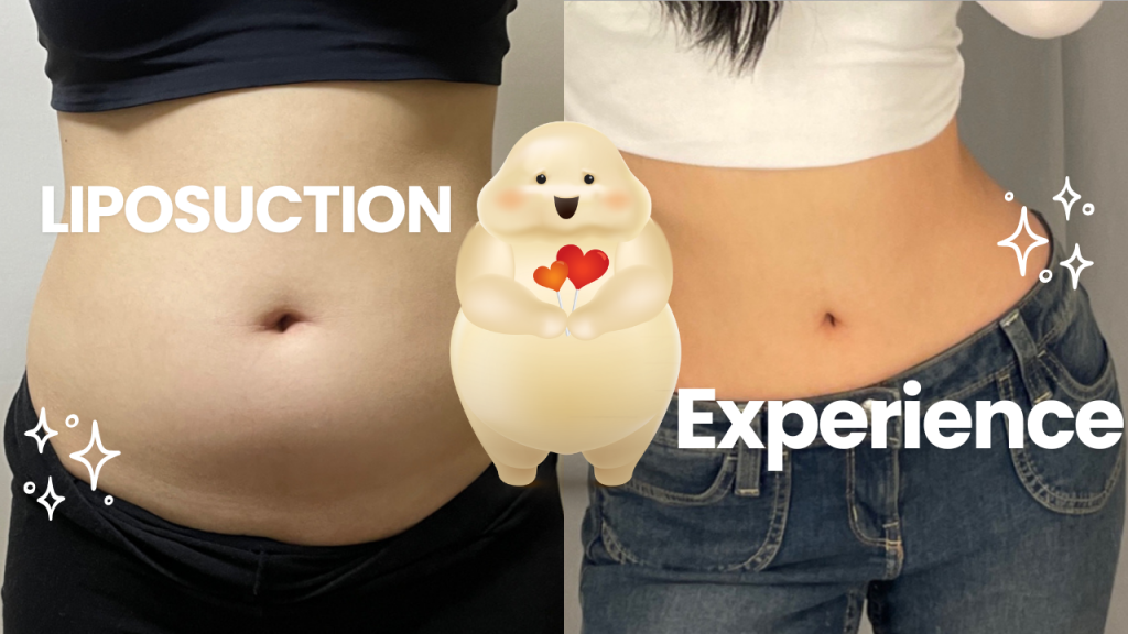 Liposuction procedure information and patient care guidance