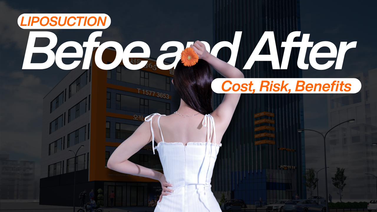 Liposuction Before and After – Cost, Risks &amp; Benefits - 365mc medical expertise and patient care