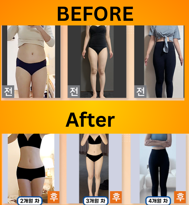 body-contouring-liposuction-herpargori-before-after-365mc