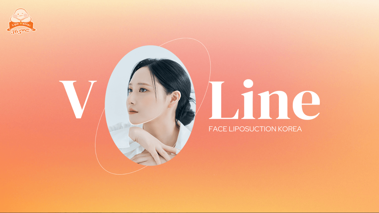 Face Liposuction in Korea for a Defined and Youthful Facial Contouring - 365mc medical expertise and patient care
