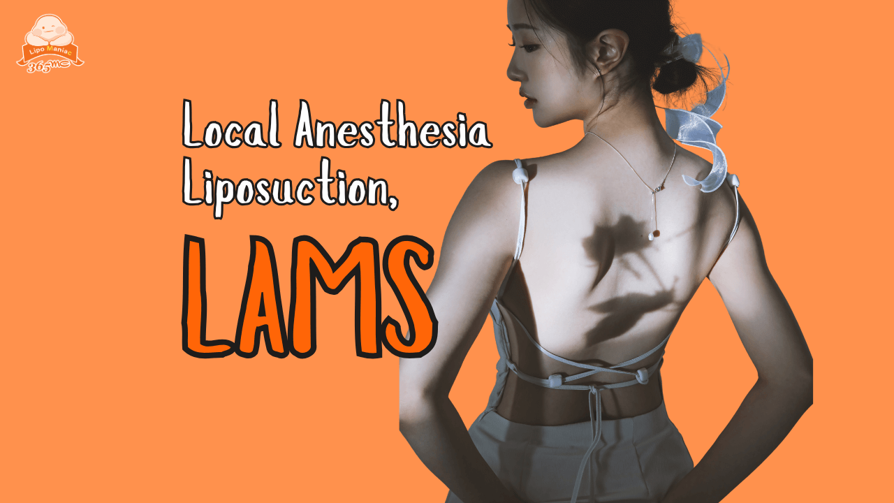 Local Anesthesia Liposuction, LAMS - 365mc medical expertise and patient care