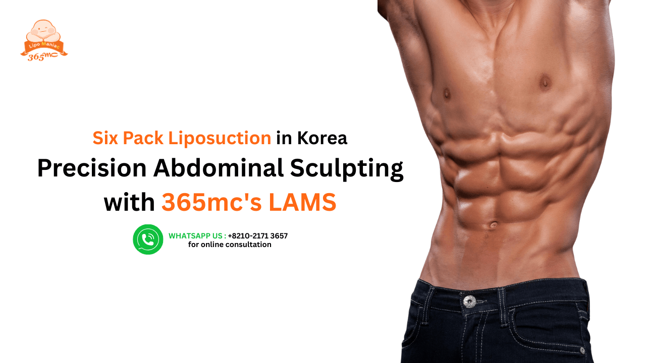 Six Pack Liposuction in Korea: Precision Abdominal Sculpting with 365mc's LAMS