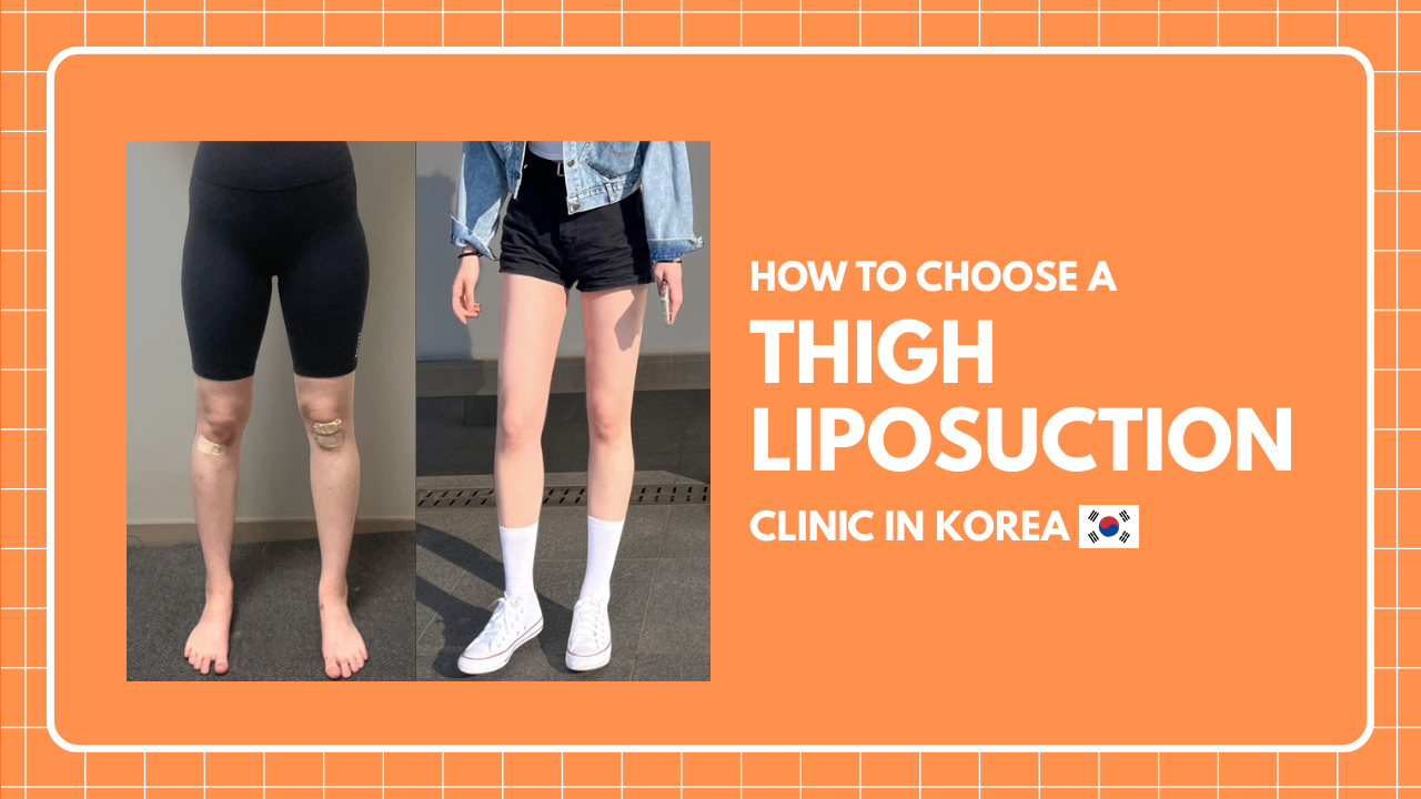 How to Choose a Thigh Liposuction Clinic in Korea - 365mc medical expertise and patient care